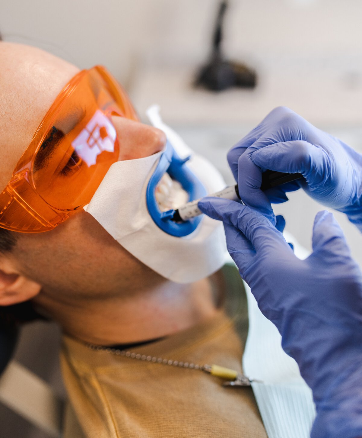 St. Albert Dental patient undergoing Professional Teeth Whitening treatment